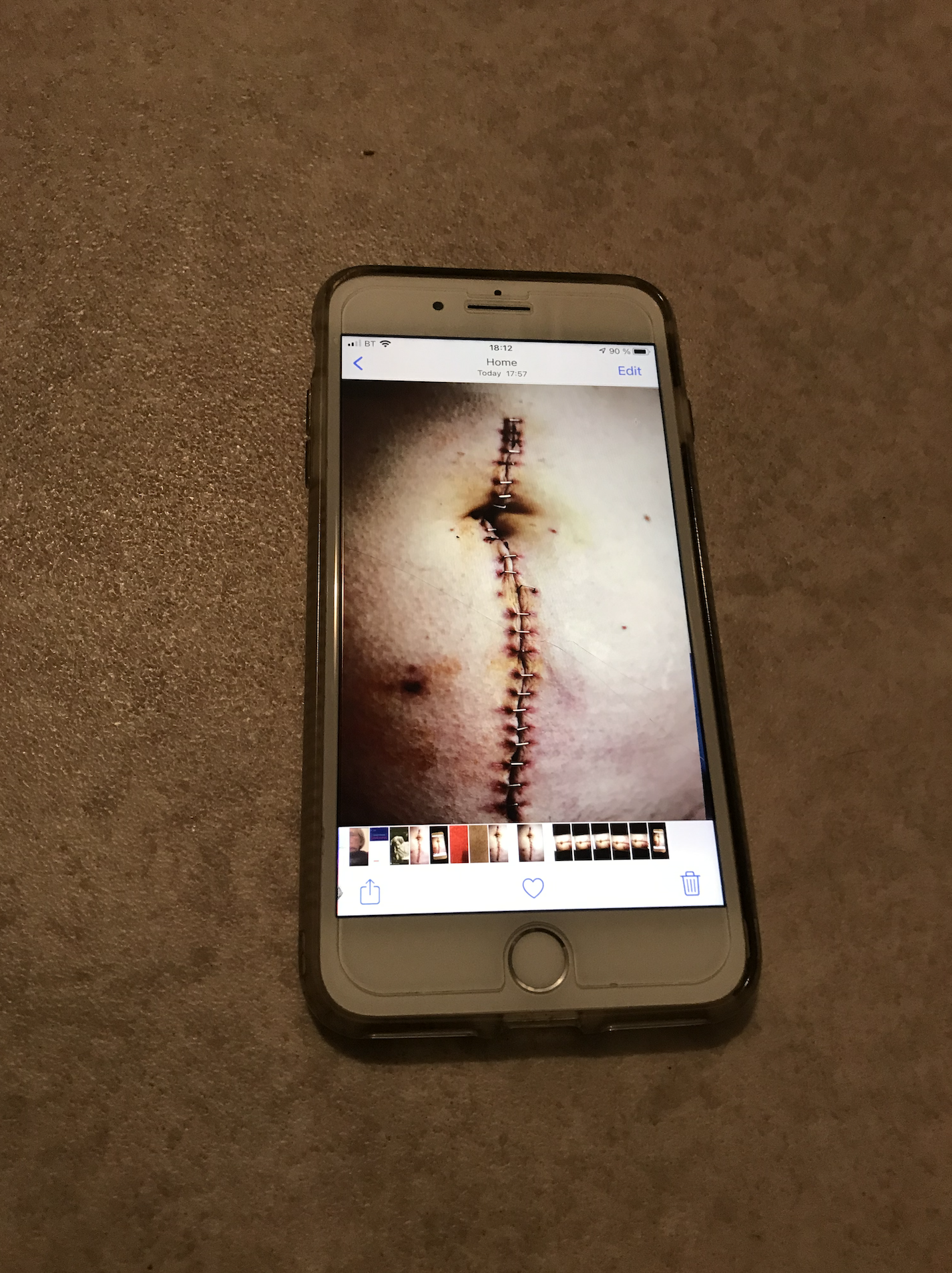 New smartphone app could transform woundcare