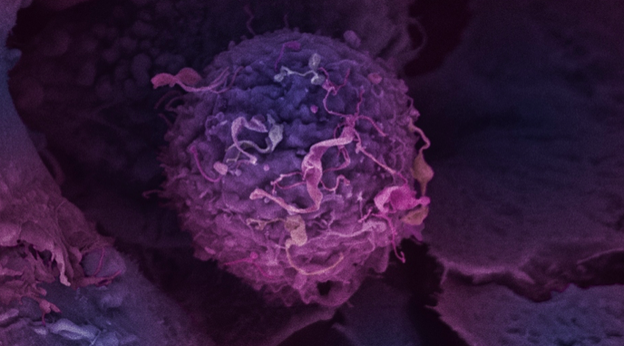 Existing drug could be used to target aggressive breast cancer