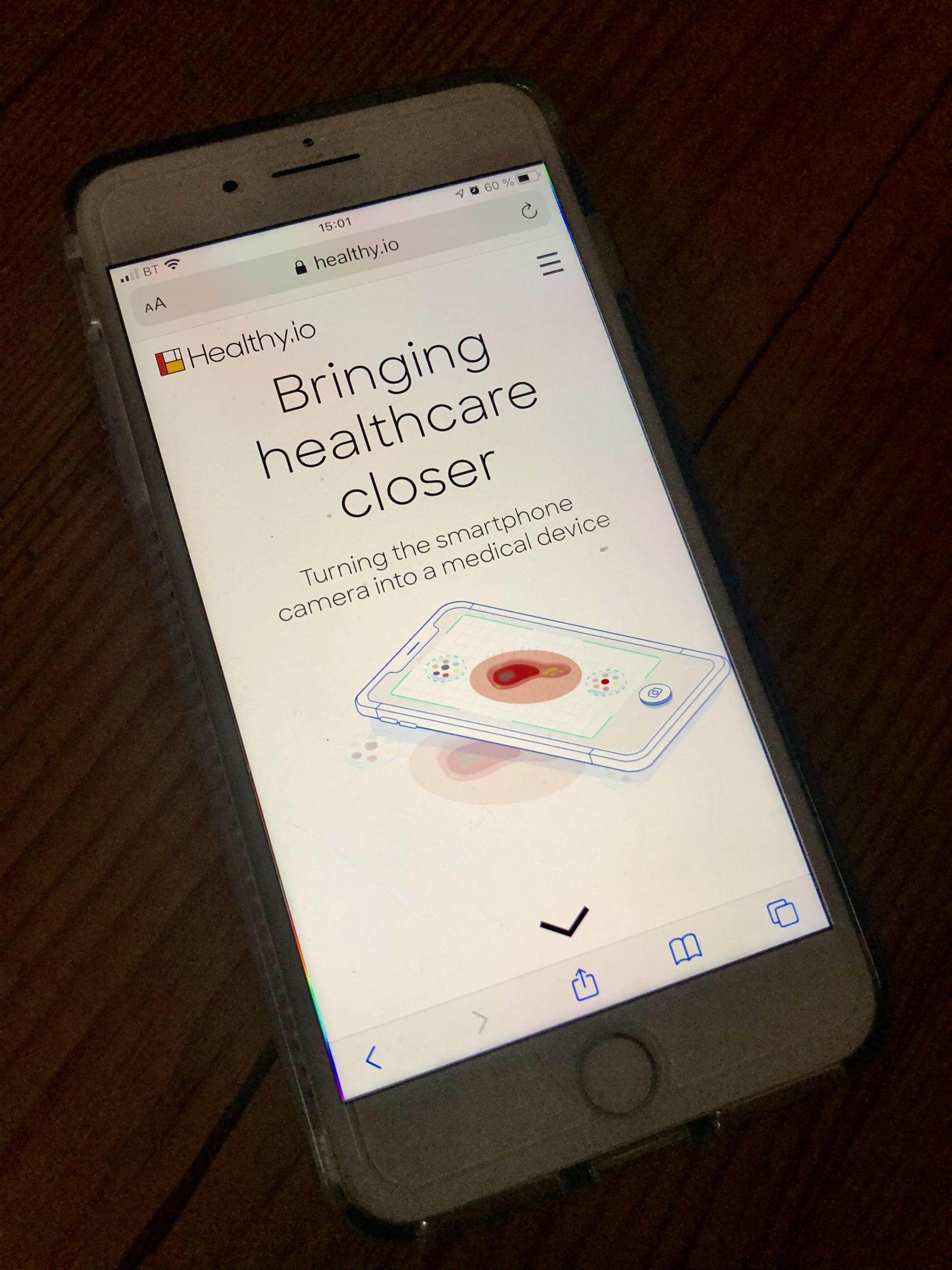 AI enables smart phones to test for early kidney disease