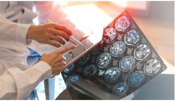 Oncology research experts launch joint effort to accelerate innovation